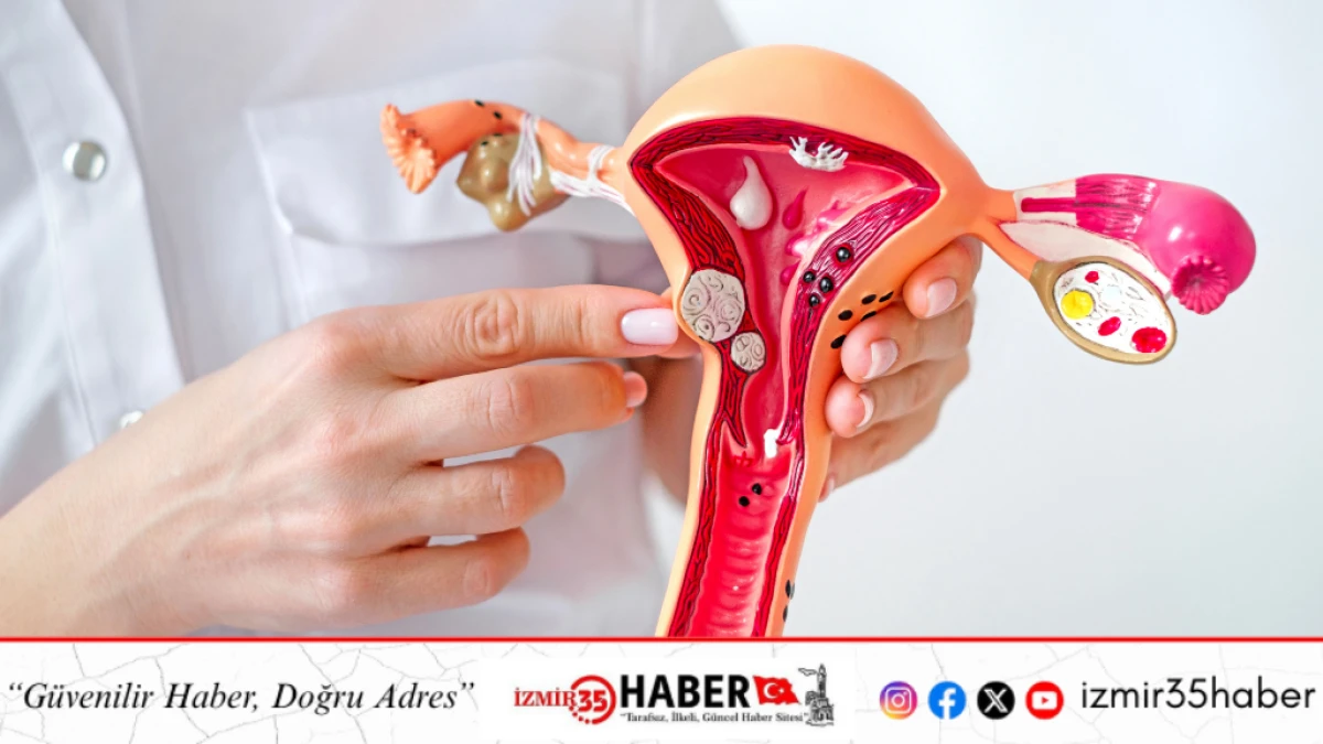 Bir&ccedil;ok Kadında Var Ancak Fark Edilmiyor: Miyom Ger&ccedil;eği