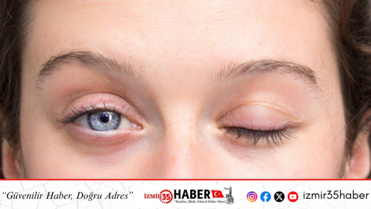 Y&uuml;z Felcinde Soğuk Hava Masum mu?